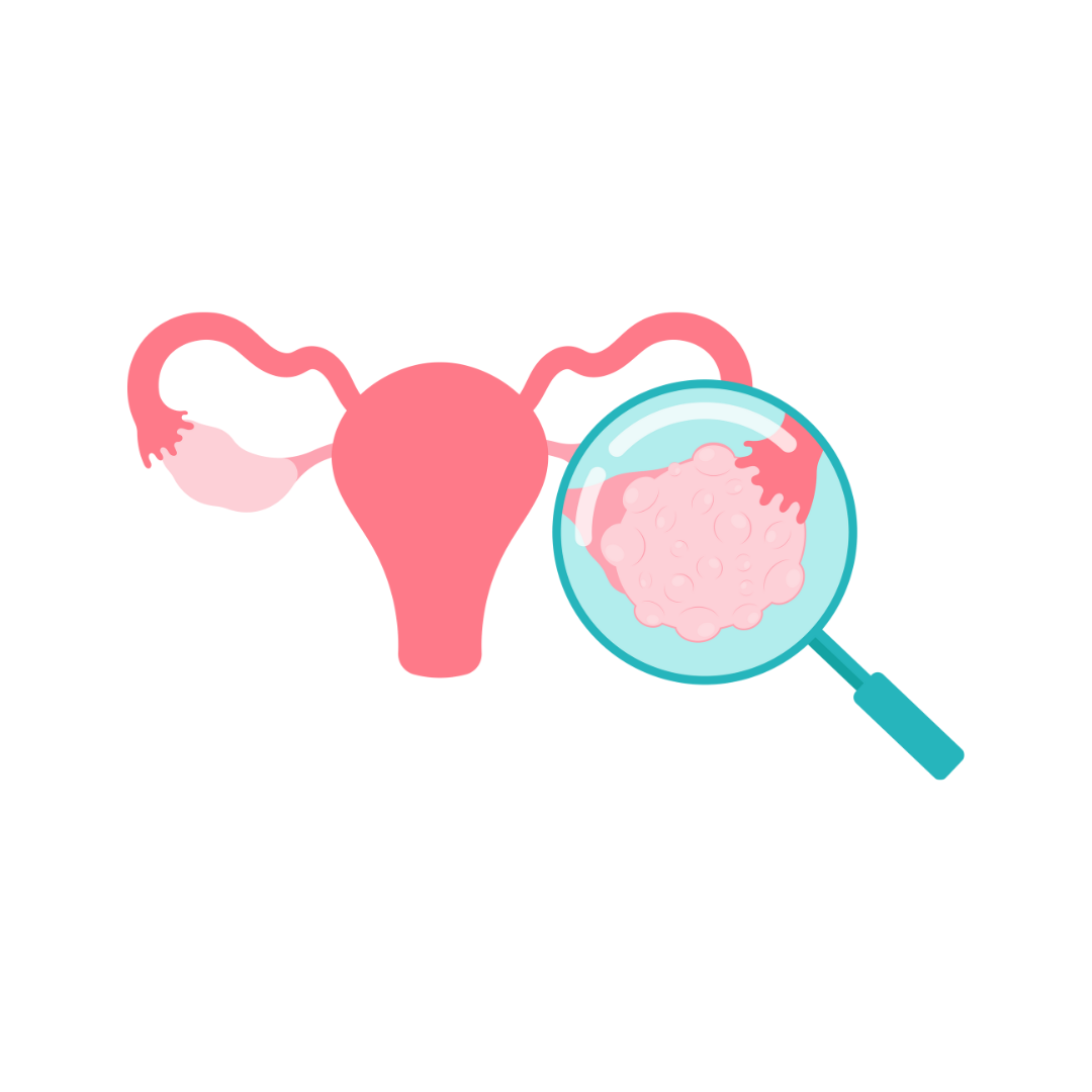 Stimulation ovarienne Phases et effets secondaires IVFforYOU